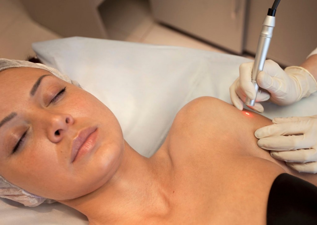 Премахване на бенки